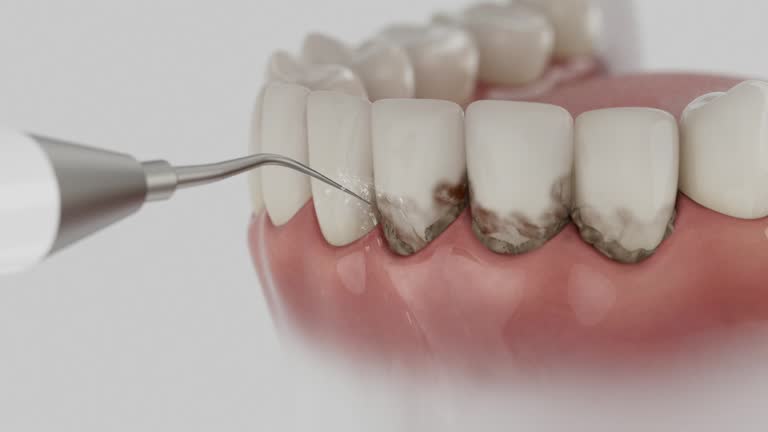 Reliable Dental Implants contractor in Cresco, IA by Smile Center Dentistry